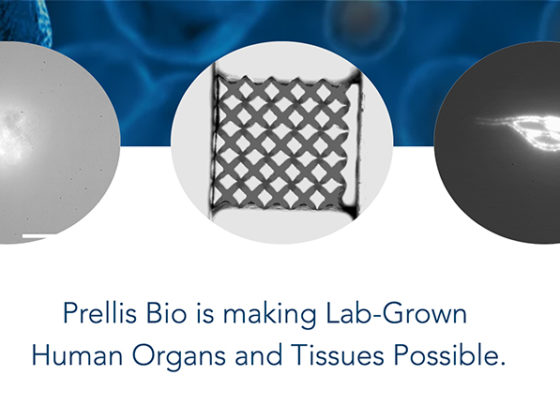 3Dプリンティング技術で人工臓器の開発を目指すPrellis Biologics